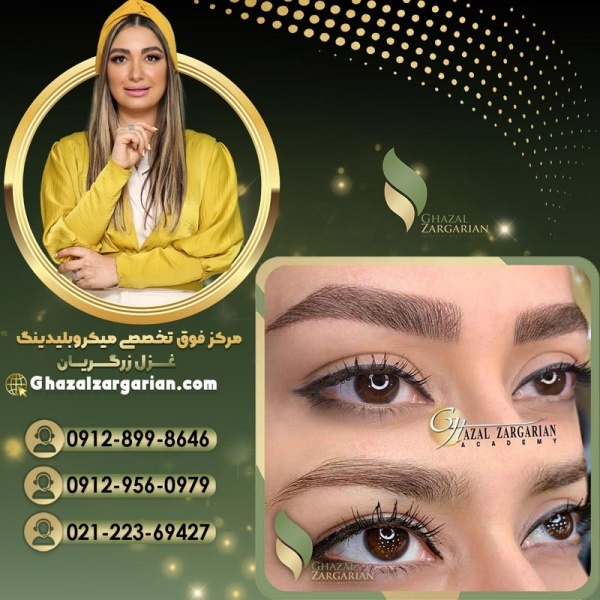بلید کرکی مویی در شمال تهران