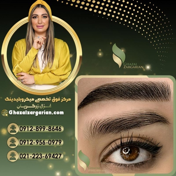 میکروبلیدینگ در غرب تهران